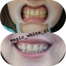 Кабинет косметического отбеливания зубов Magic White