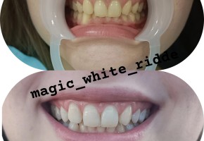 Кабинет косметического отбеливания зубов Magic White