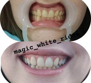 Кабинет косметического отбеливания зубов Magic White