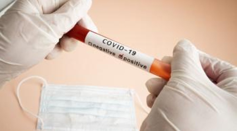 348 зараженных коронавирусом зарегистрировано в Казахстане на утро 1-го апреля
