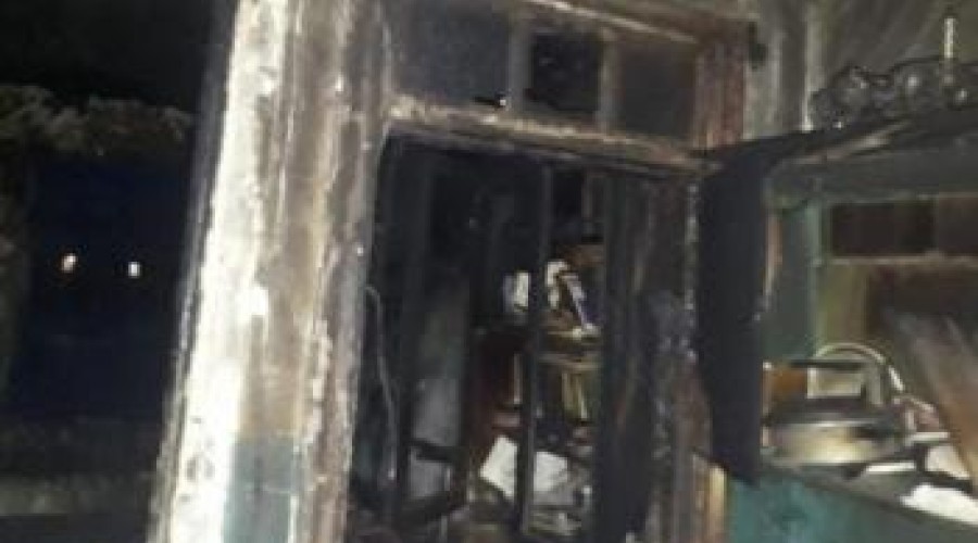 Мужчина получил ожоги во время пожара в жилом доме