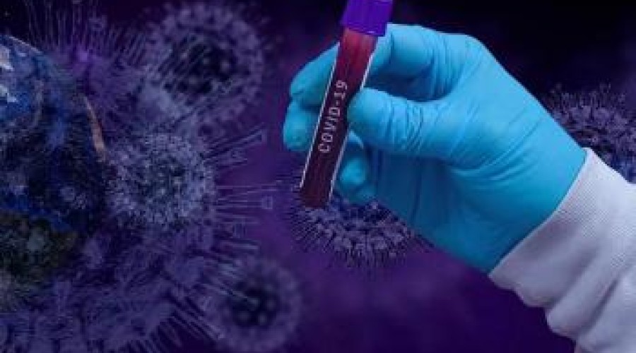 За сутки в ВКО зарегистрировано 23 случая заражения коронавирусной инфекцией